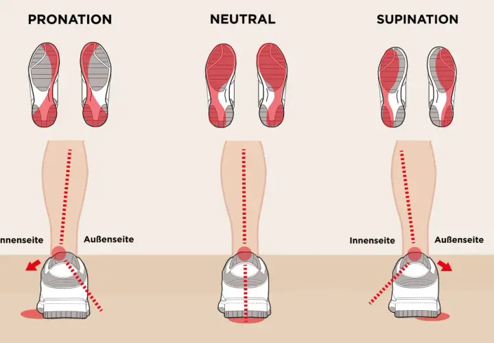 Illustration zeigt drei Laufstile: Pronation, Neutral und Supination. Bei Pronation knickt der Fuß nach innen ab.