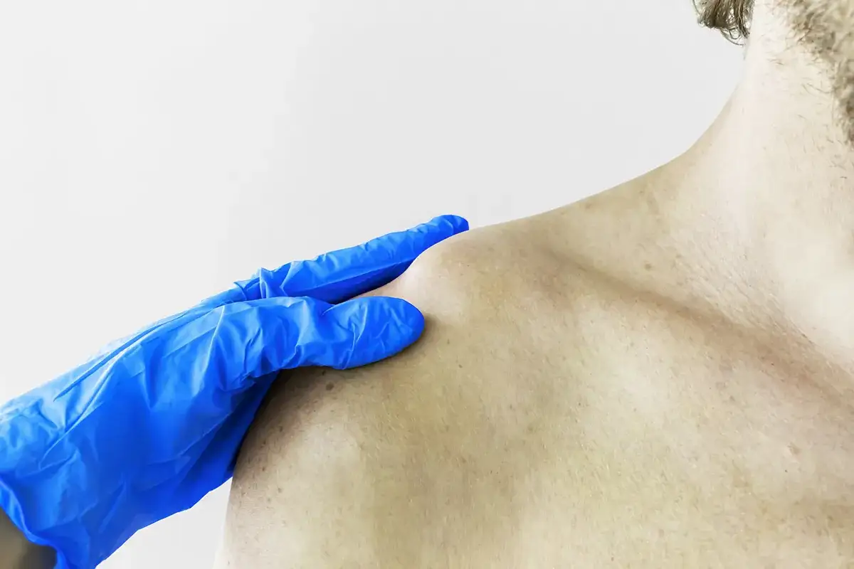 Blauer Handschuh tastet das SCG Gelenk ab, um eine m&ouml;gliche Verletzung zu diagnostizieren.